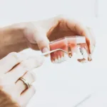 Ile średnio kosztuje wybielanie zębów?