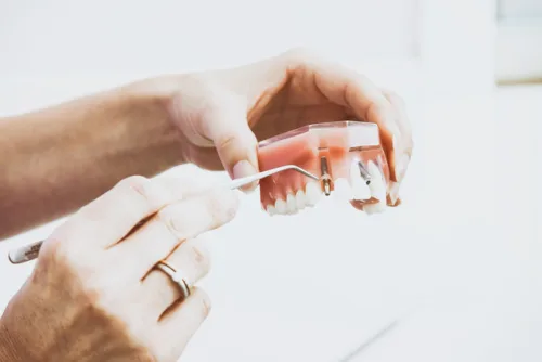 Ile średnio kosztuje wybielanie zębów?