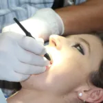 Na czym polega proces konturowania zębów? Korzyści z zastosowania bondingu stomatologicznego