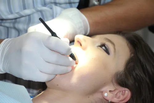 Na czym polega proces konturowania zębów? Korzyści z zastosowania bondingu stomatologicznego