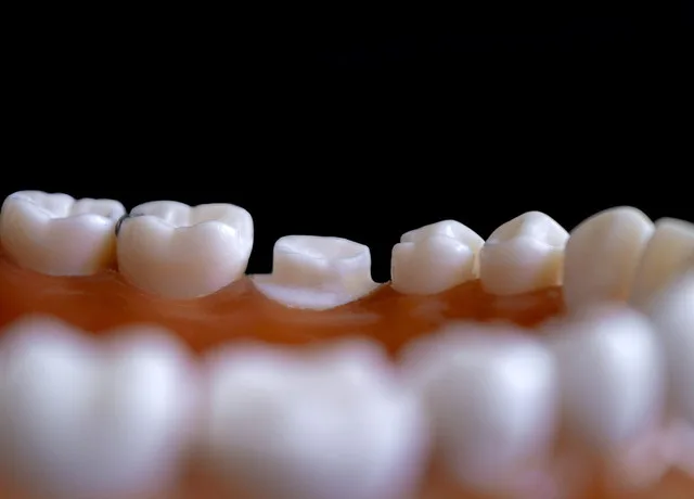 Jaki rodzaj protezy wybrać przy całkowitym braku zębów?